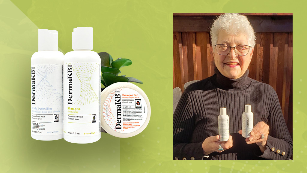 Une retraitée rend grâce au shampoing DermaKB! Disparues les démangeaisons du cuir chevelu et les pellicules incommodantes des 20 dernières années!